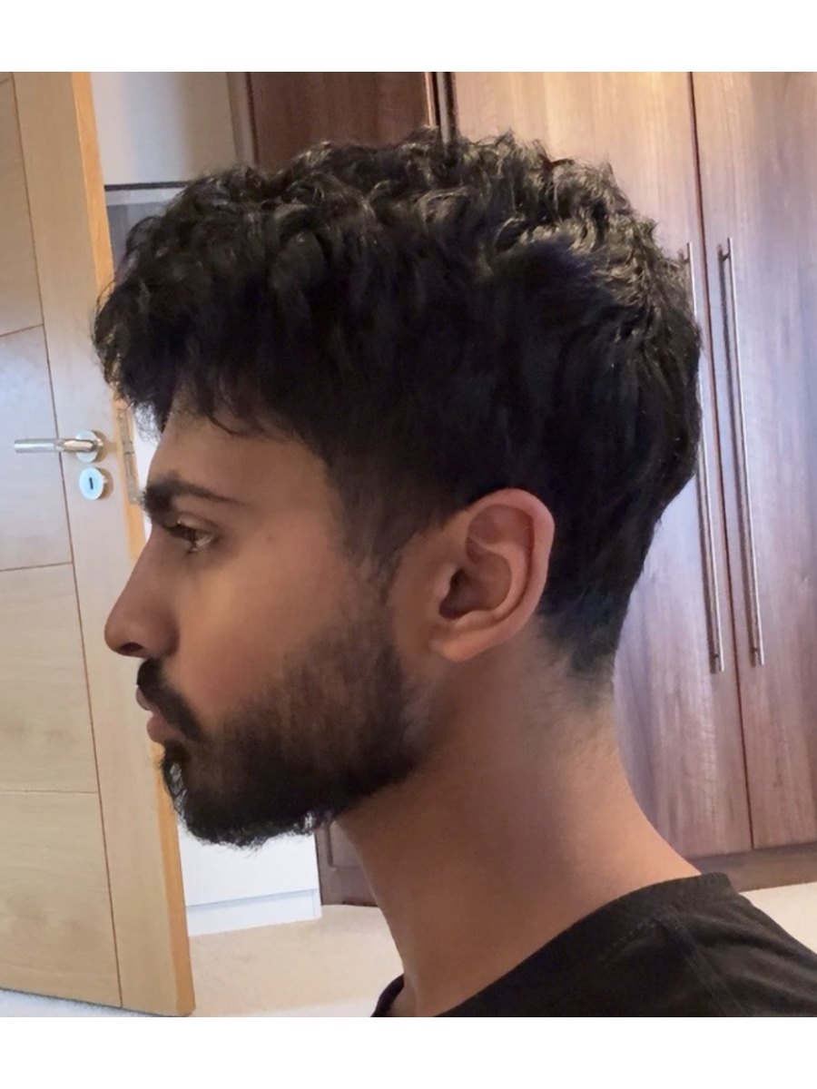 Member transformation 3 before
