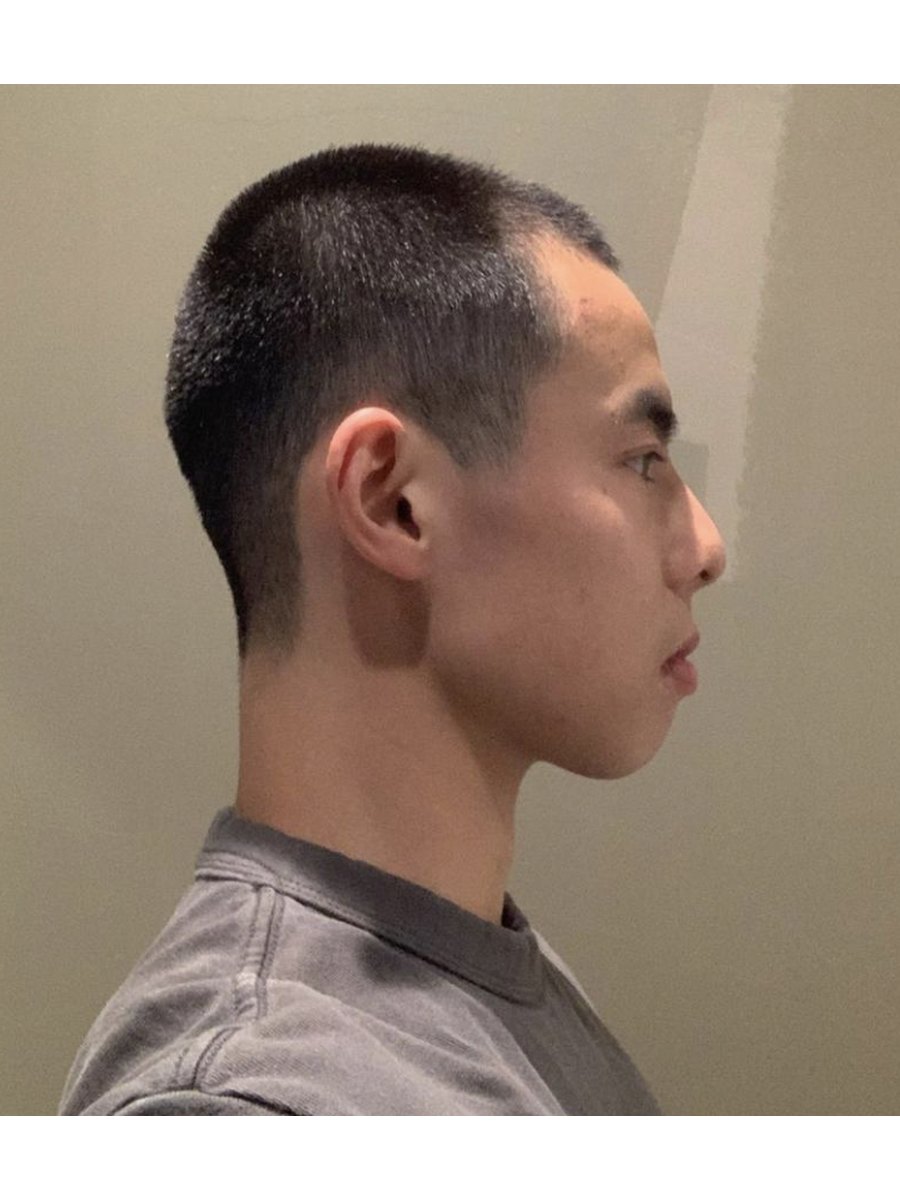 Member transformation 7 after