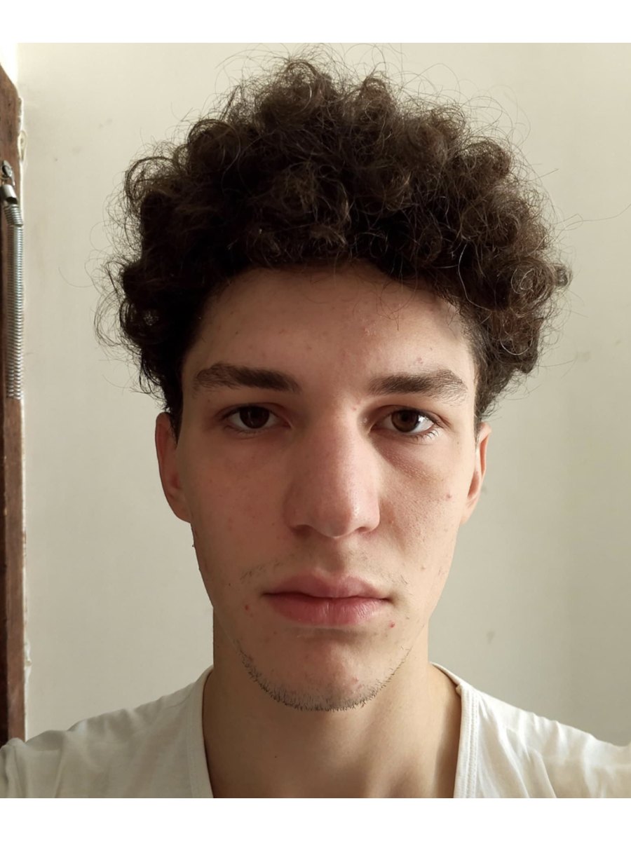 Member transformation 10 before