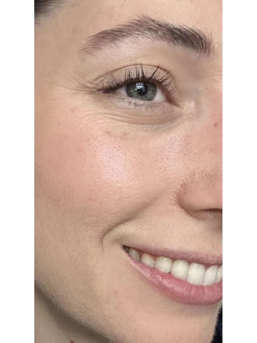 Member transformation 17 after