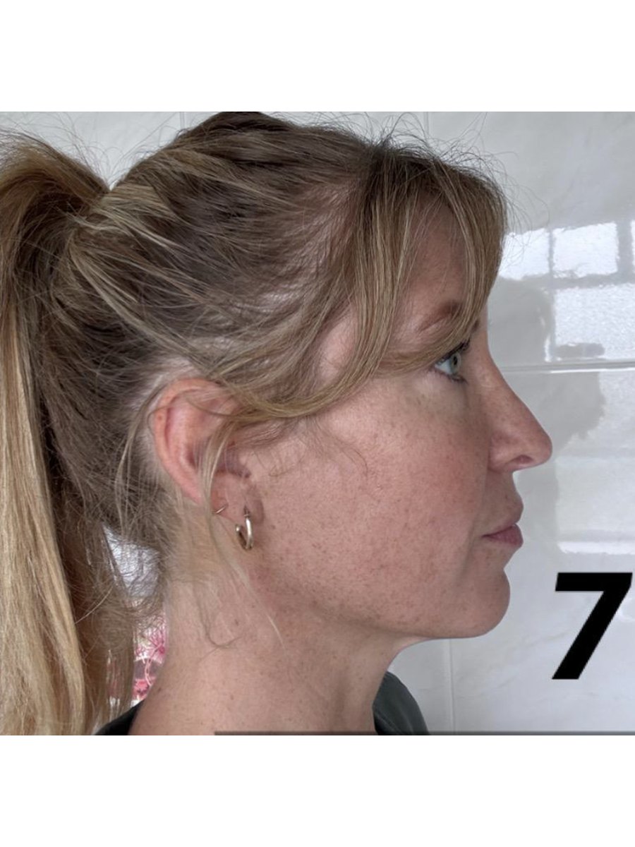 Member transformation 19 after
