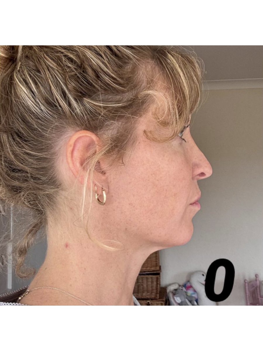 Member transformation 19 before