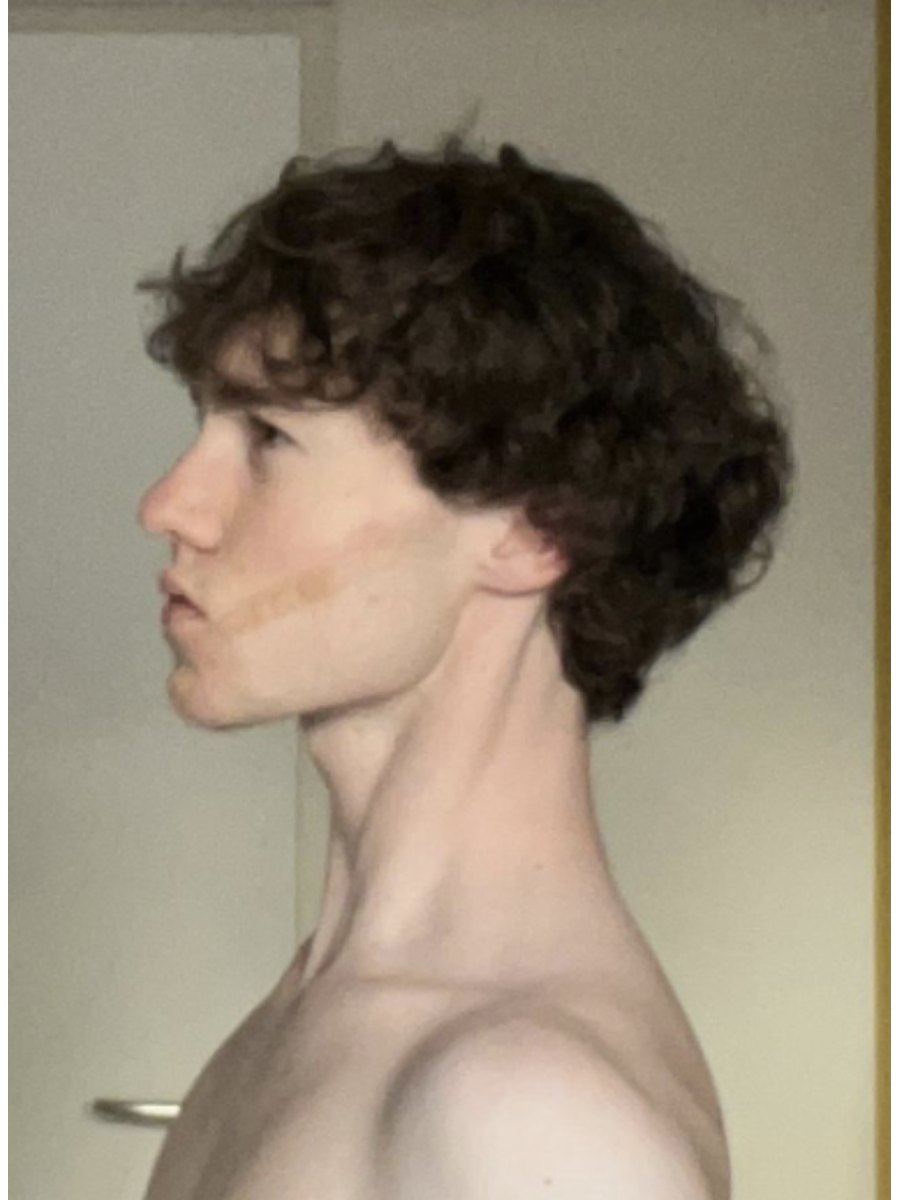 Member transformation 23 after