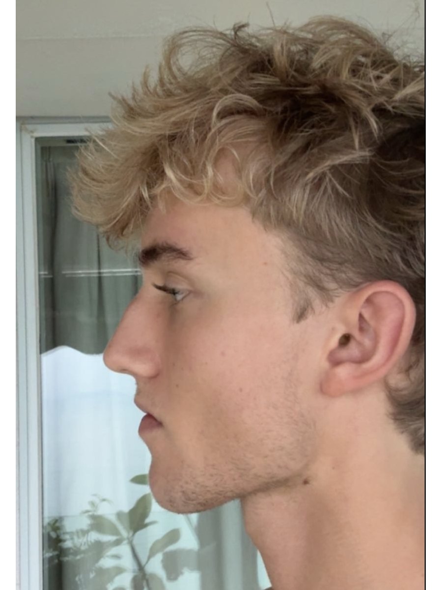 Member transformation 27 after