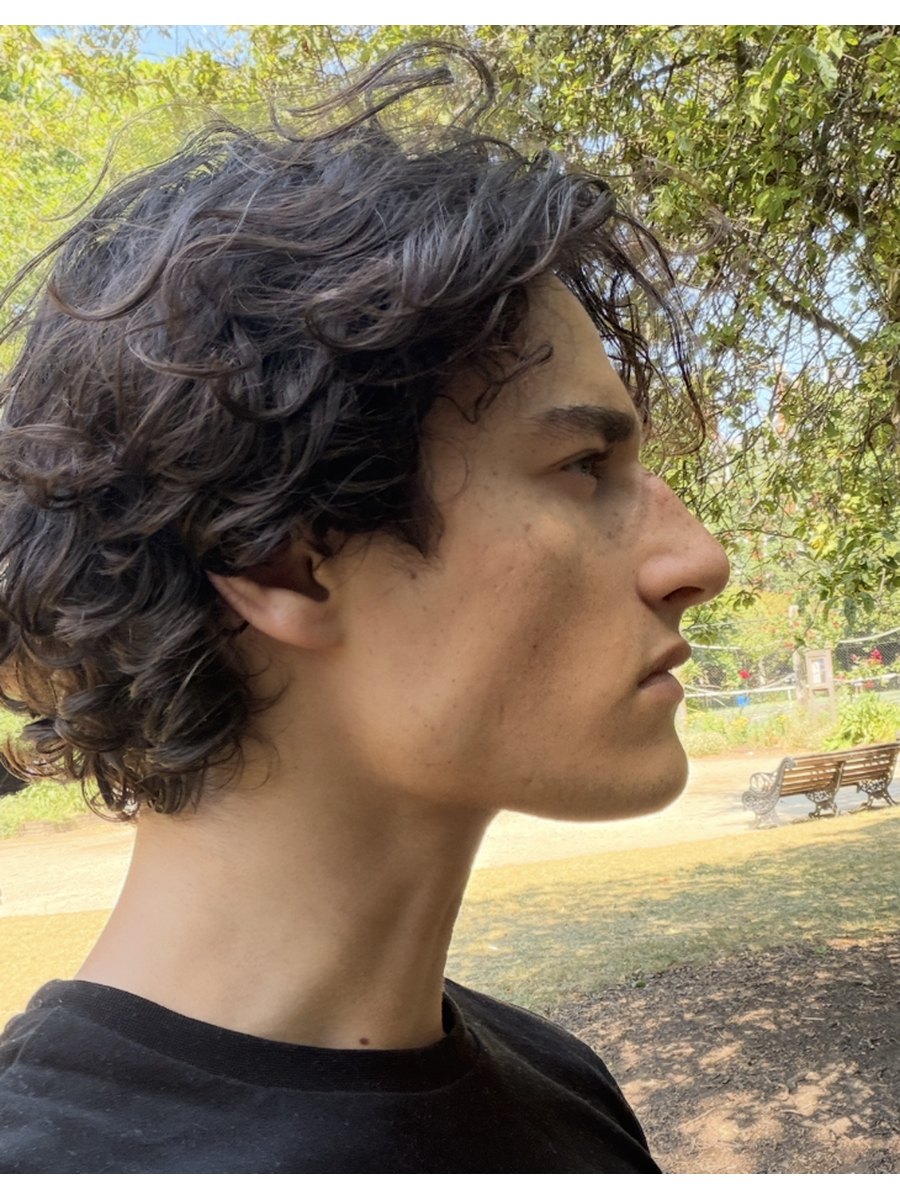 Side profile after