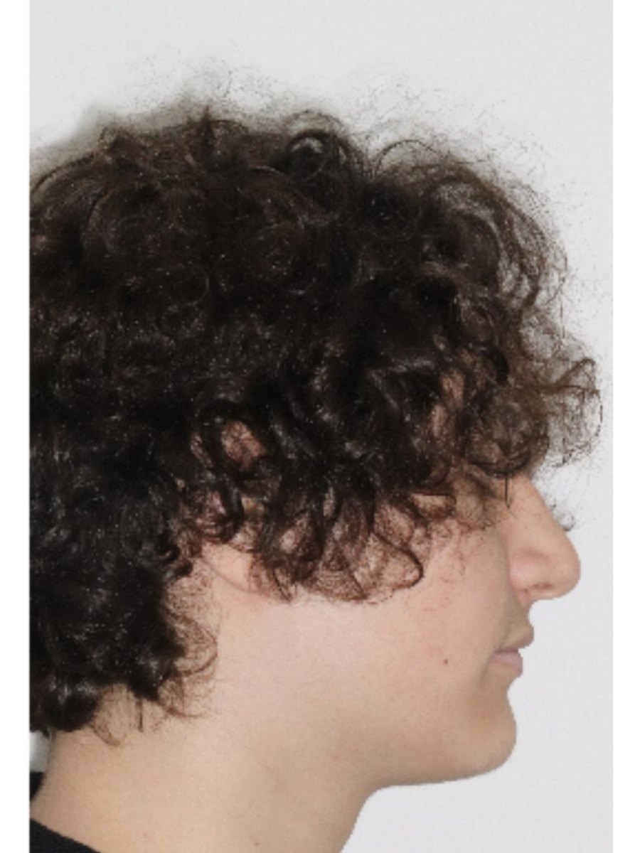 Side profile before