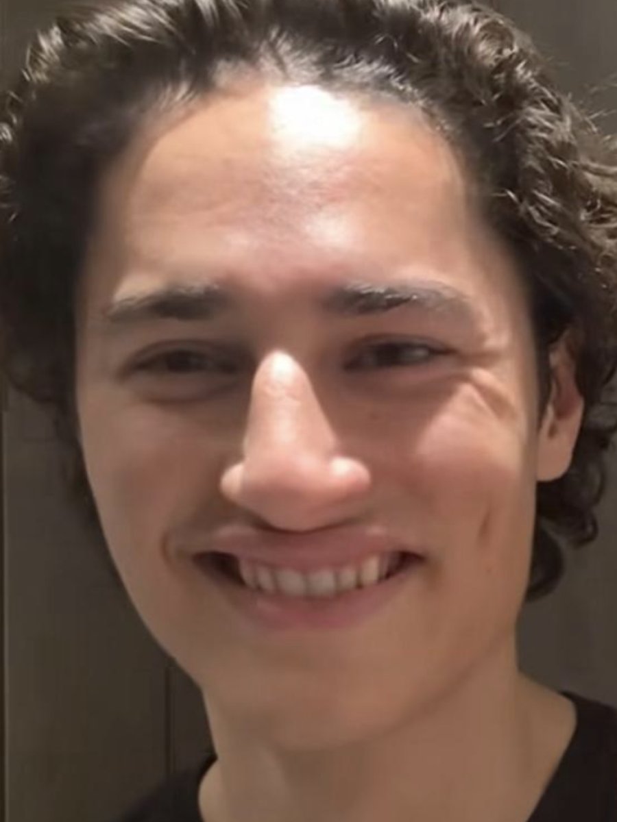 Smile before